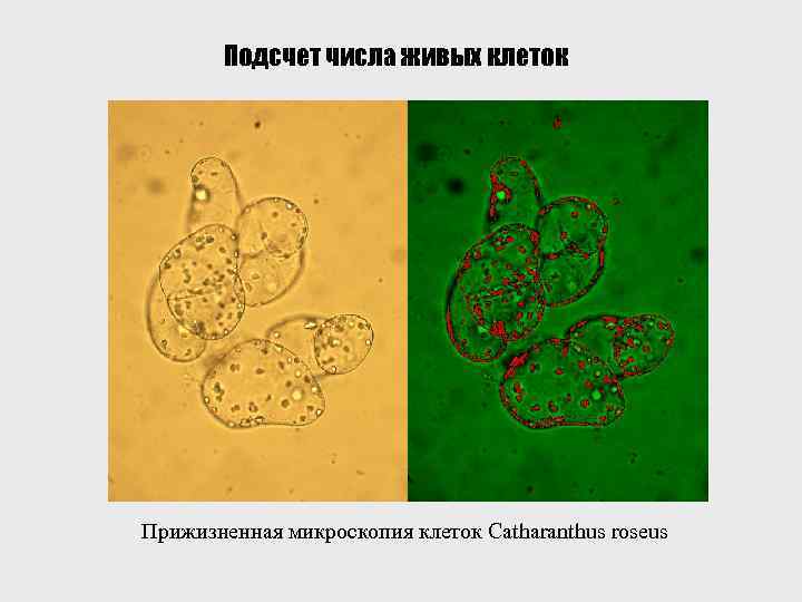 Подсчет числа живых клеток Прижизненная микроскопия клеток Catharanthus roseus 