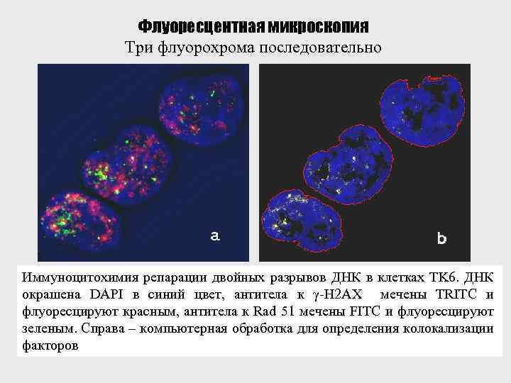 Флуоресцентная микроскопия Три флуорохрома последовательно Иммуноцитохимия репарации двойных разрывов ДНК в клетках TK 6.