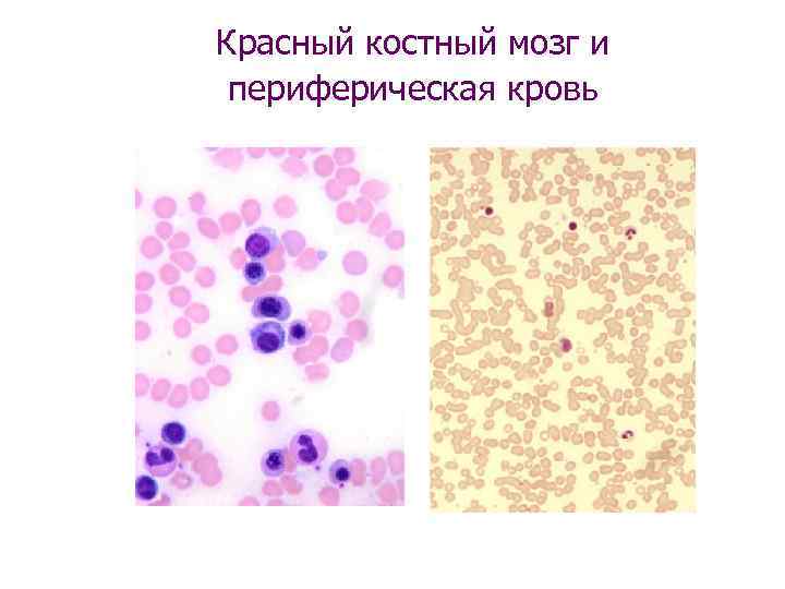 Красный костный мозг и периферическая кровь 