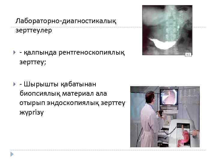 Лабораторно-диагностикалық зерттеулер - қалпында рентгеноскопиялық зерттеу; - Шырышты қабатынан биопсиялық материал ала отырып эндоскопиялық