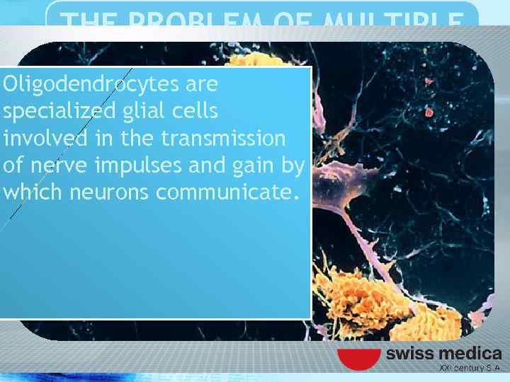 THE PROBLEM OF MULTIPLE SCLEROSIS Oligodendrocytes are specialized glial cells involved in the transmission