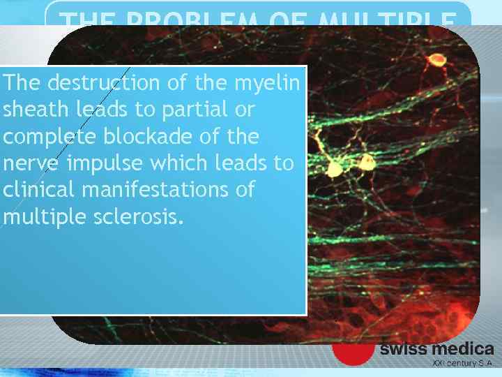 THE PROBLEM OF MULTIPLE SCLEROSIS The destruction of the myelin sheath leads to partial