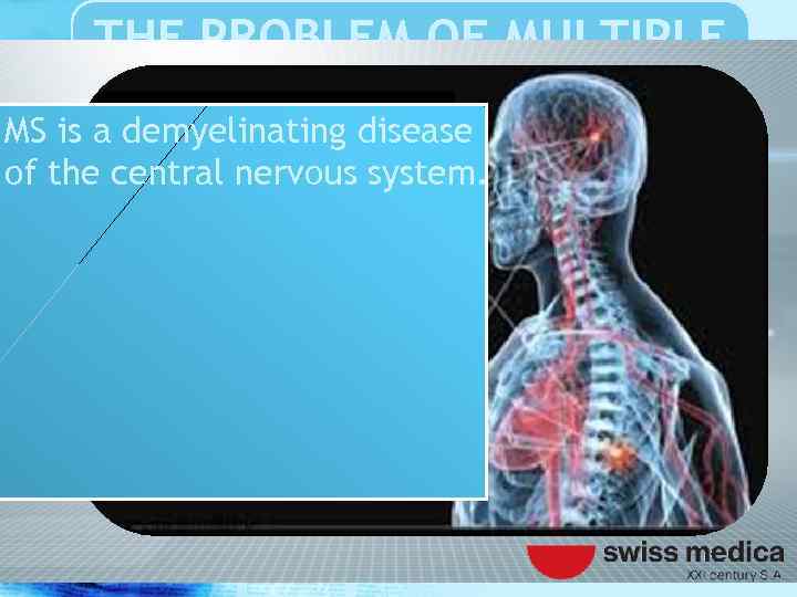 THE PROBLEM OF MULTIPLE SCLEROSIS MS is a demyelinating disease of the central nervous