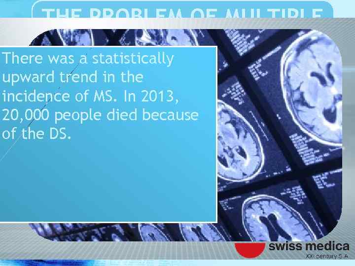 THE PROBLEM OF MULTIPLE SCLEROSIS There was a statistically upward trend in the incidence