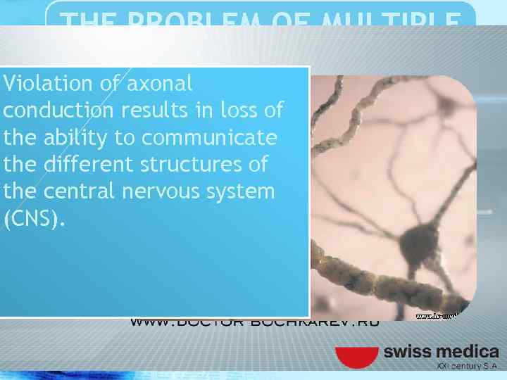 THE PROBLEM OF MULTIPLE SCLEROSIS Violation of axonal conduction results in loss of the