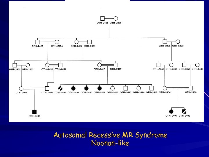 4 1 2 5 Autosomal Recessive MR Syndrome Noonan-like 