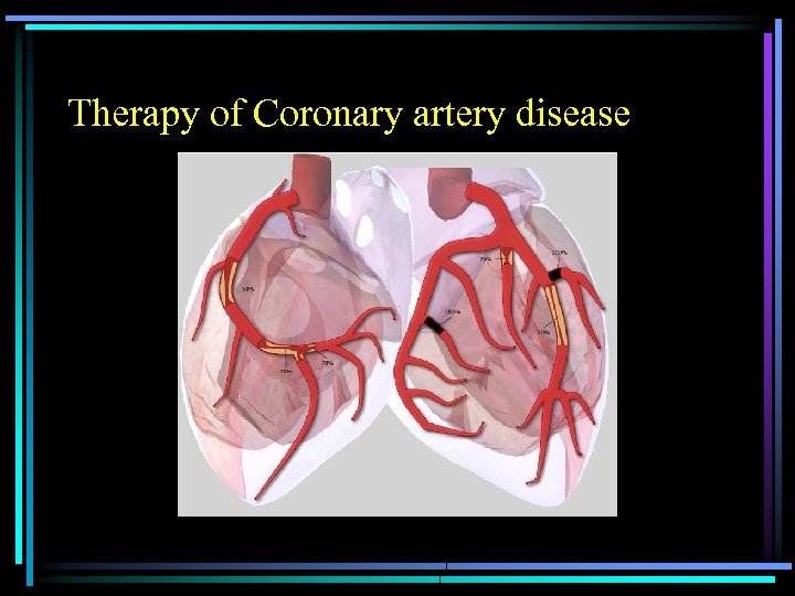 Therapy of Coronary artery disease 