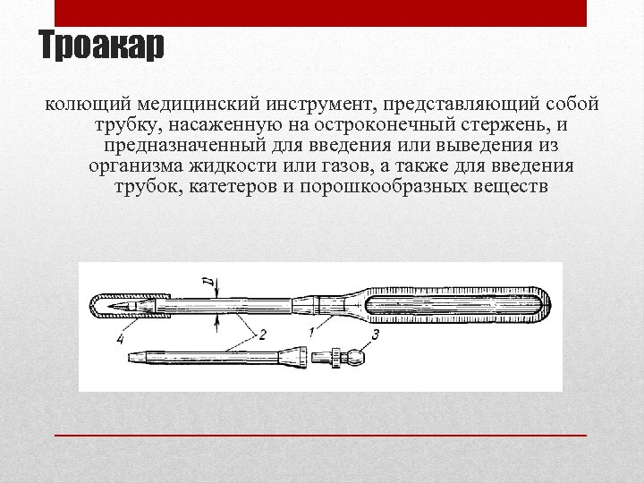 Троакар колющий медицинский инструмент, представляющий собой трубку, насаженную на остроконечный стержень, и предназначенный для