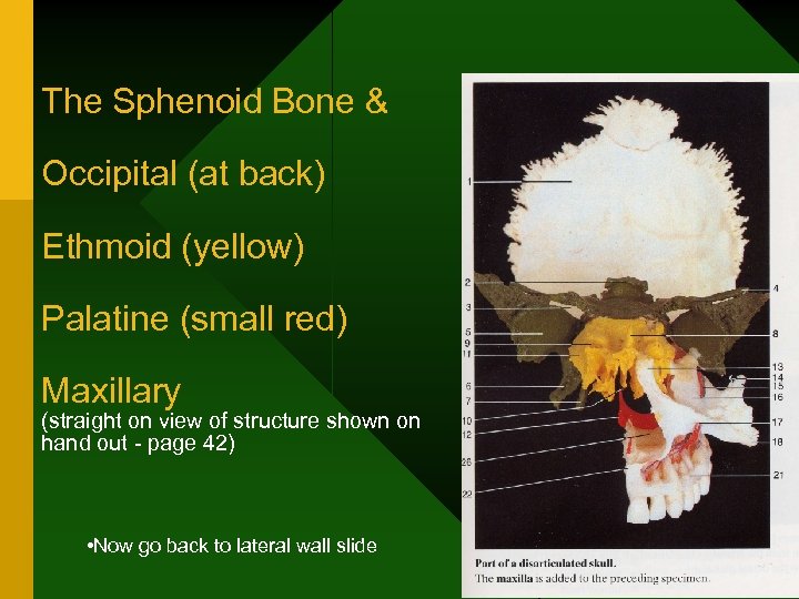 The Sphenoid Bone & Occipital (at back) Ethmoid (yellow) Palatine (small red) Maxillary (straight