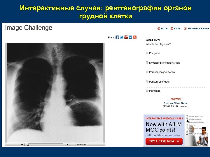Интерактивные случаи: рентгенография органов грудной клетки 