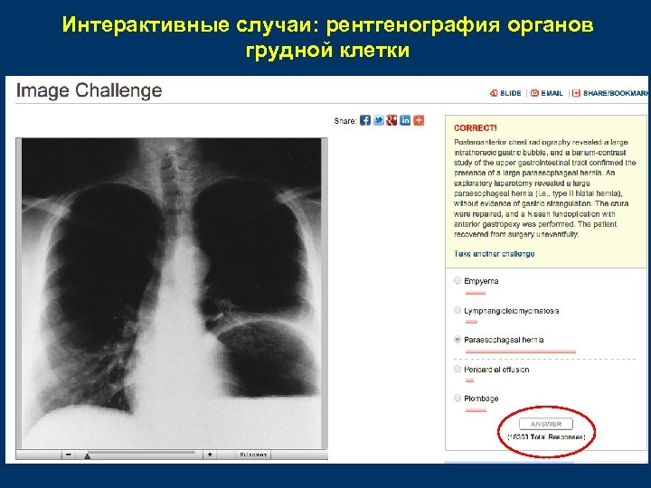 Интерактивные случаи: рентгенография органов грудной клетки 