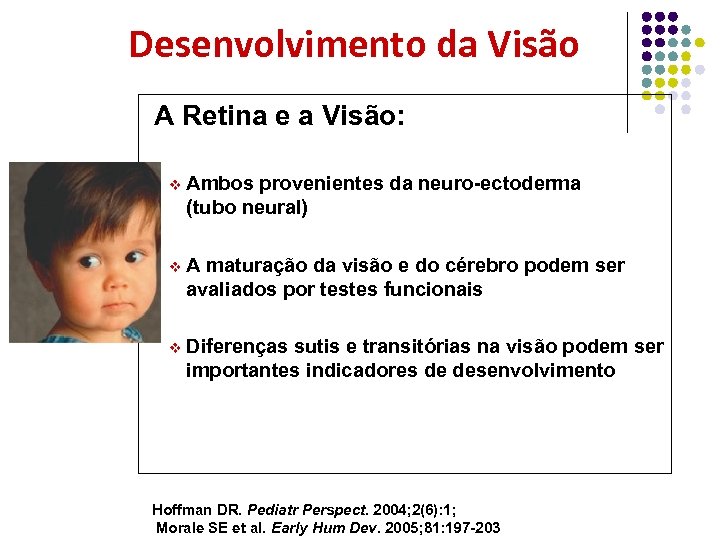  Desenvolvimento da Visão A Retina e a Visão: v Ambos provenientes da neuro-ectoderma