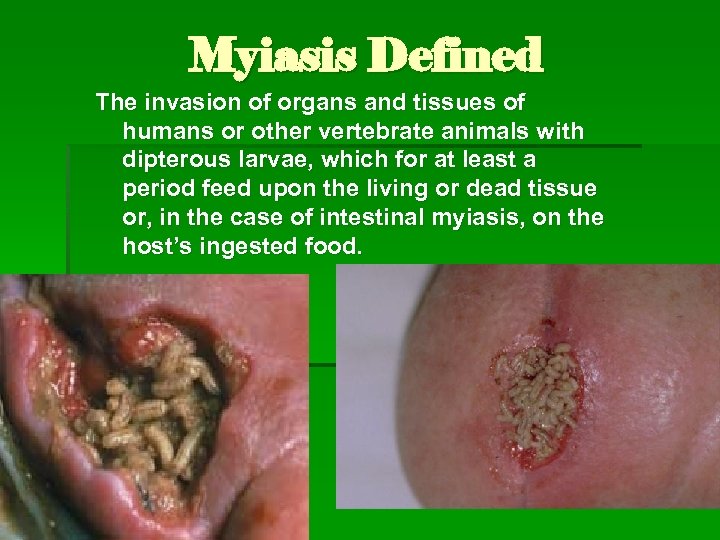 Myiasis Defined The invasion of organs and tissues of humans or other vertebrate animals
