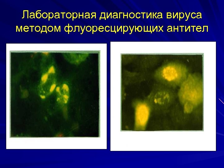 Лабораторная диагностика вируса методом флуоресцирующих антител 