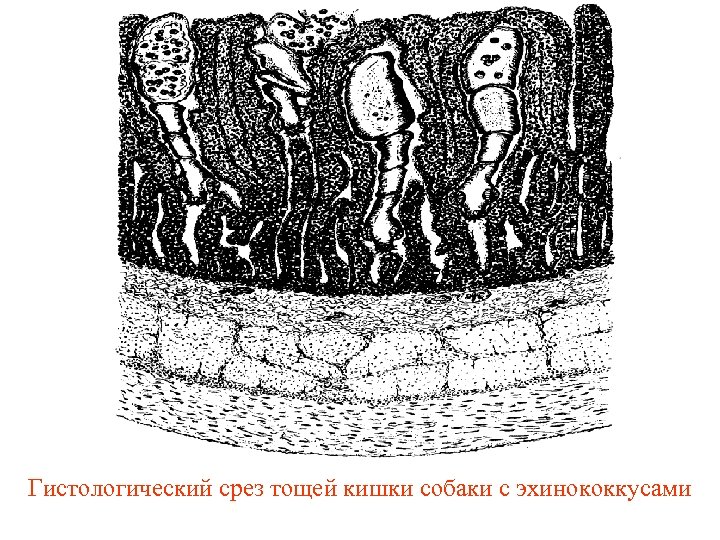 Гистологический срез тощей кишки собаки с эхинококкусами 