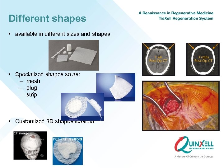 Different shapes • available in different sizes and shapes • Specialized shapes so as: