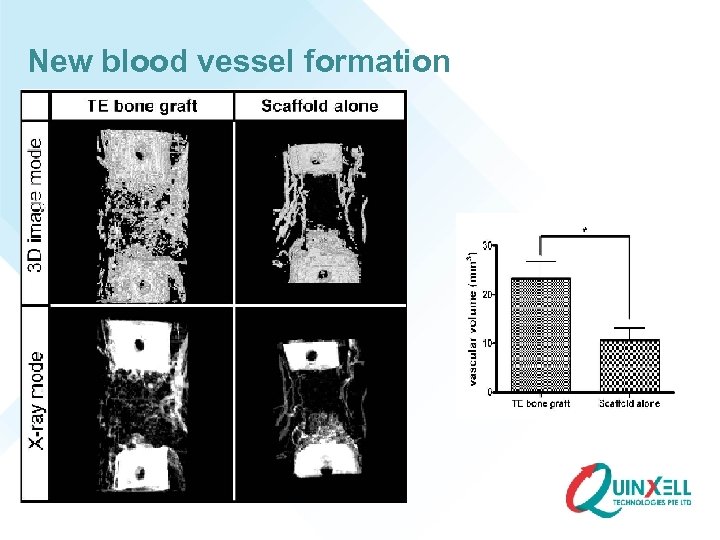 New blood vessel formation 