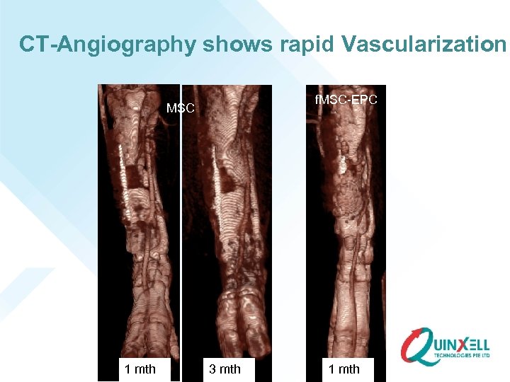 CT-Angiography shows rapid Vascularization f. MSC-EPC MSC 1 mth 3 mth 1 mth 