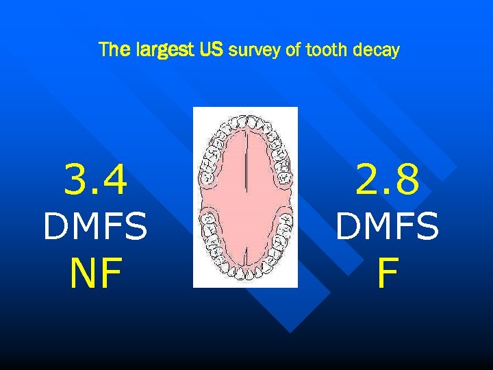 The largest US survey of tooth decay 3. 4 DMFS NF 2. 8 DMFS