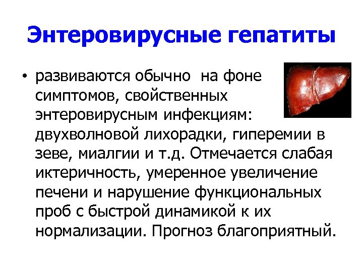 Энтеровирусные гепатиты • развиваются обычно на фоне симптомов, свойственных энтеровирусным инфекциям: двухволновой лихорадки, гиперемии