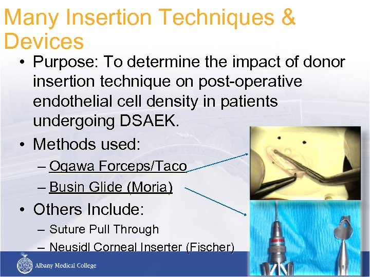 Many Insertion Techniques & Devices • Purpose: To determine the impact of donor insertion
