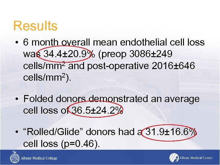 Results • 6 month overall mean endothelial cell loss was 34. 4± 20. 9%