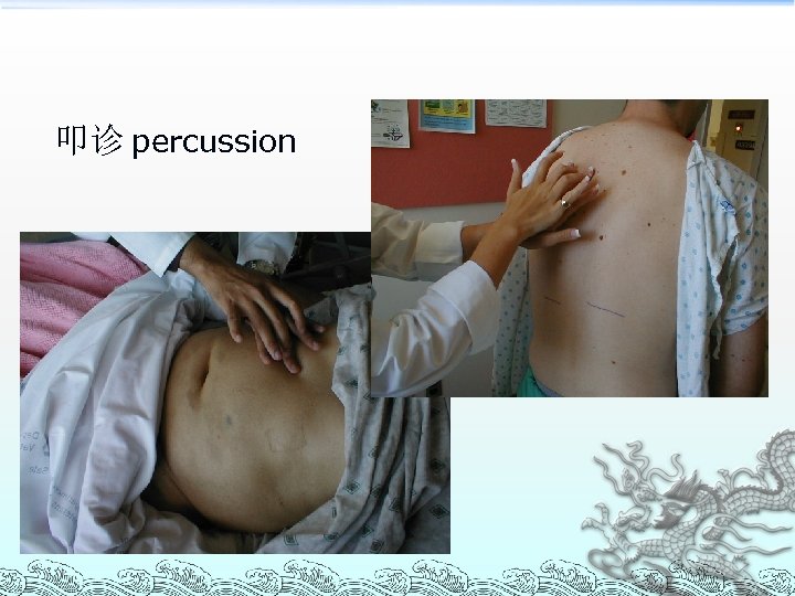 叩诊 percussion 