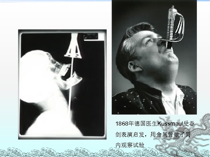 1868年德国医生Kussmaul受吞 剑表演启发，用金属管做了胃 内观察试验 