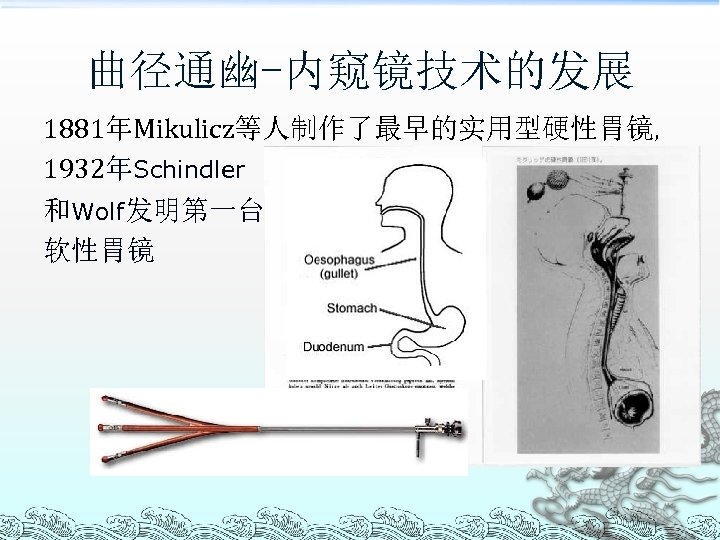 曲径通幽-内窥镜技术的发展 1881年Mikulicz等人制作了最早的实用型硬性胃镜, 1932年Schindler 和Wolf发明第一台 软性胃镜 