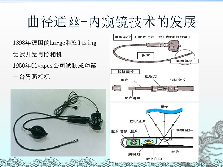 曲径通幽-内窥镜技术的发展 1898年德国的Large和Meltzing 尝试开发胃照相机 1950年Olympus公司试制成功第 一台胃照相机 