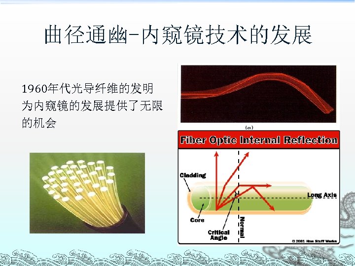 曲径通幽-内窥镜技术的发展 1960年代光导纤维的发明 为内窥镜的发展提供了无限 的机会 