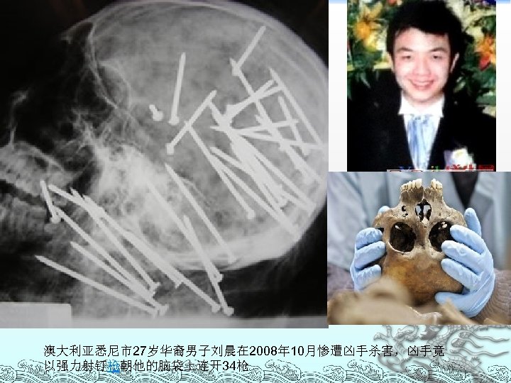 澳大利亚悉尼市27岁华裔男子刘晨在 2008年 10月惨遭凶手杀害，凶手竟 以强力射钉枪朝他的脑袋上连开34枪 