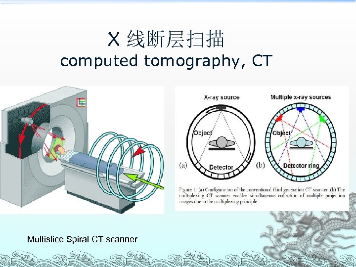 X 线断层扫描 computed tomography, CT Multislice Spiral CT scanner 