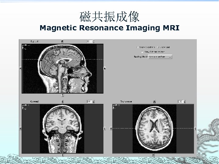 磁共振成像 Magnetic Resonance Imaging MRI 