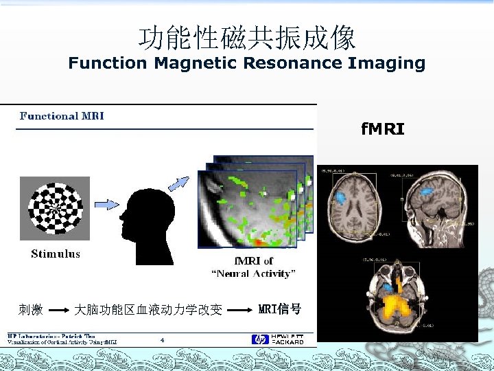 功能性磁共振成像 Function Magnetic Resonance Imaging f. MRI 刺激 大脑功能区血液动力学改变 MRI信号 