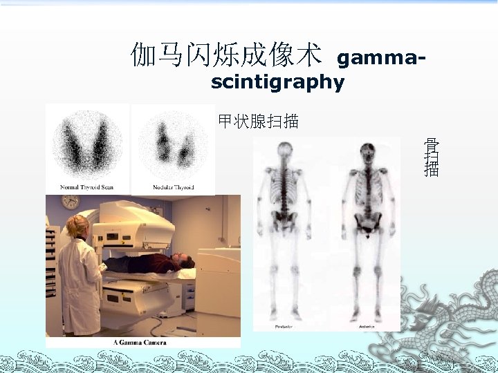 伽马闪烁成像术 gammascintigraphy 甲状腺扫描 骨 扫 描 
