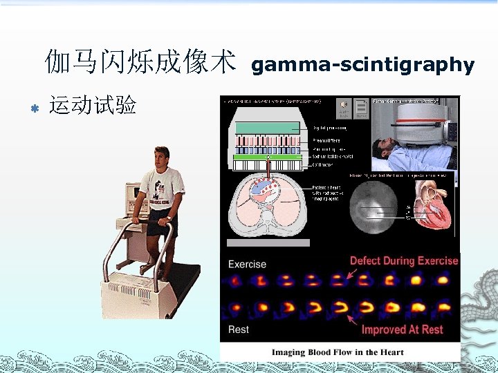 伽马闪烁成像术 ß 运动试验 gamma-scintigraphy 