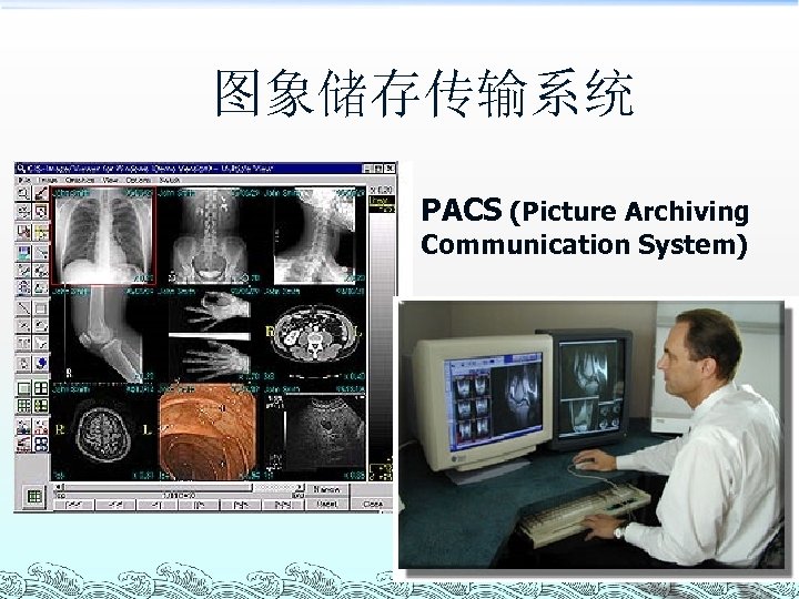 图象储存传输系统 PACS (Picture Archiving Communication System) 