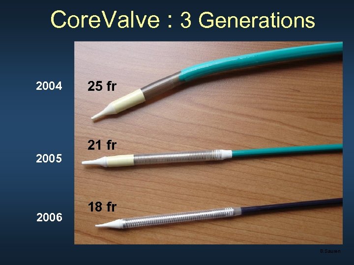 Core. Valve : 3 Generations 2004 2005 2006 25 fr 21 fr 18 fr