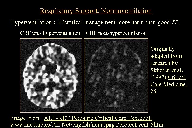 Respiratory Support: Normoventilation Hyperventilation : Historical management more harm than good ? ? ?