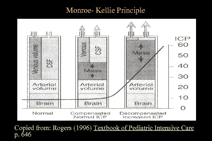 Monroe- Kellie Principle Copied from: Rogers (1996) Textbook of Pediatric Intensive Care p. 646