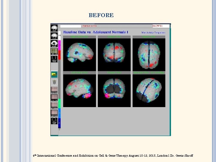 BEFORE 4 th International Conference and Exhibition on Cell & Gene Therapy August 10