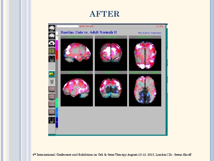 AFTER 4 th International Conference and Exhibition on Cell & Gene Therapy August 10