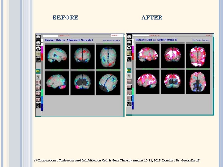 BEFORE AFTER 4 th International Conference and Exhibition on Cell & Gene Therapy August
