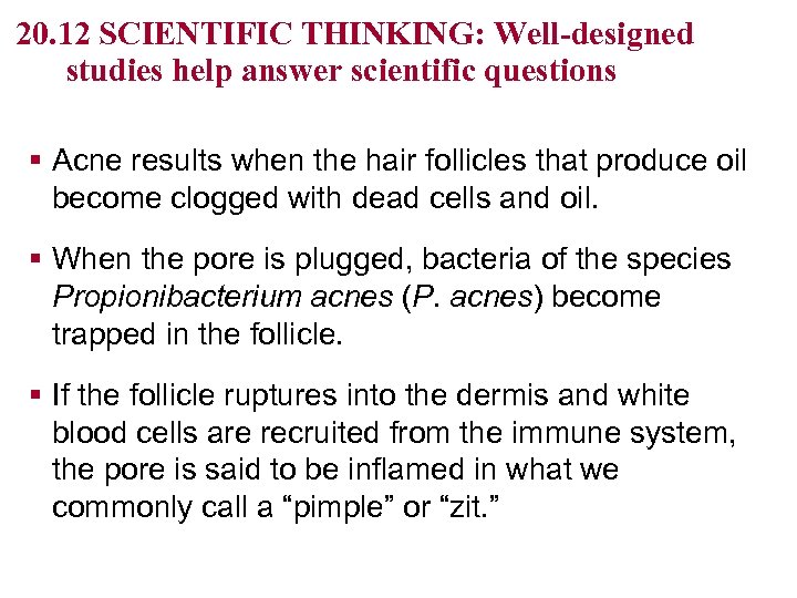 20. 12 SCIENTIFIC THINKING: Well-designed studies help answer scientific questions § Acne results when
