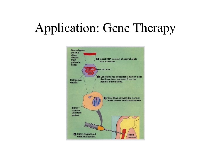 Application: Gene Therapy 