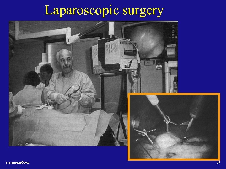 Laparoscopic surgery Leo Joskowicz© 2000 15 
