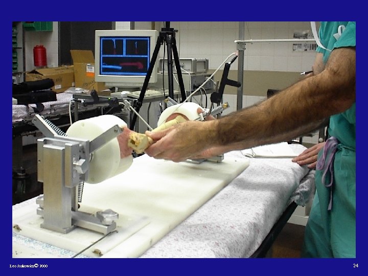 Leo Joskowicz© 2000 24 