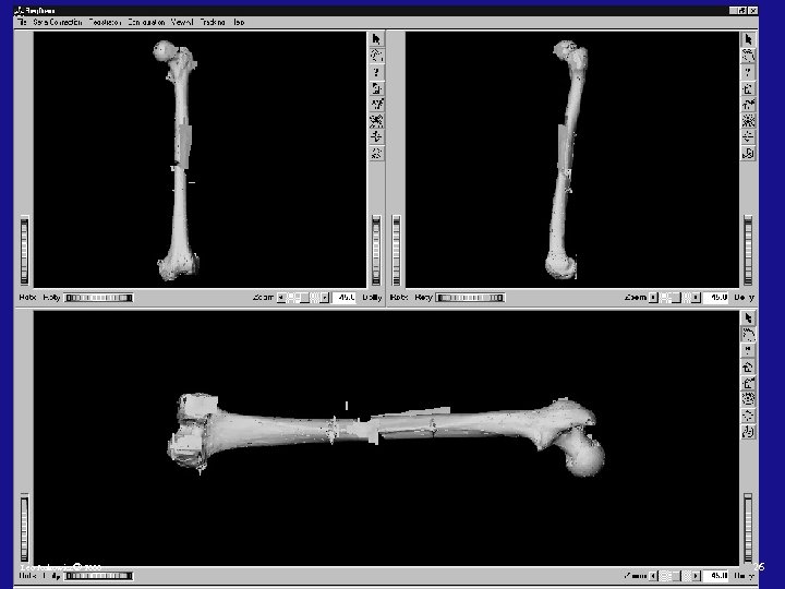 Leo Joskowicz© 2000 26 