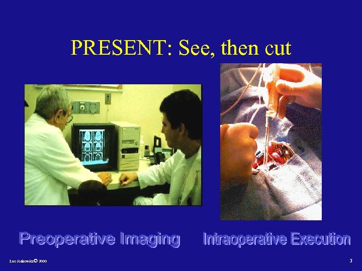 PRESENT: See, then cut Leo Joskowicz© 2000 3 